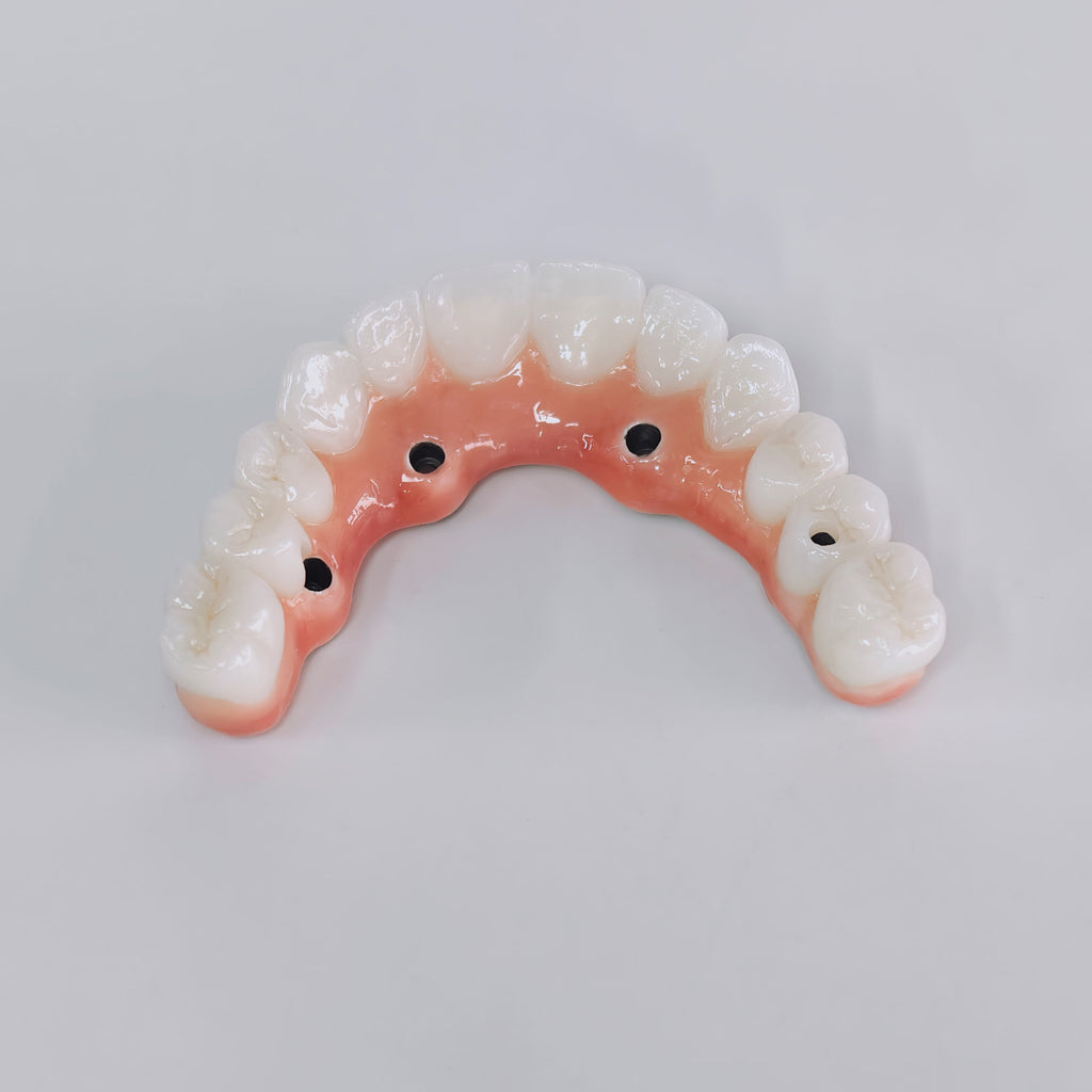 Zirconia-Enamel Hybrid Malo Bridge Aesthetic