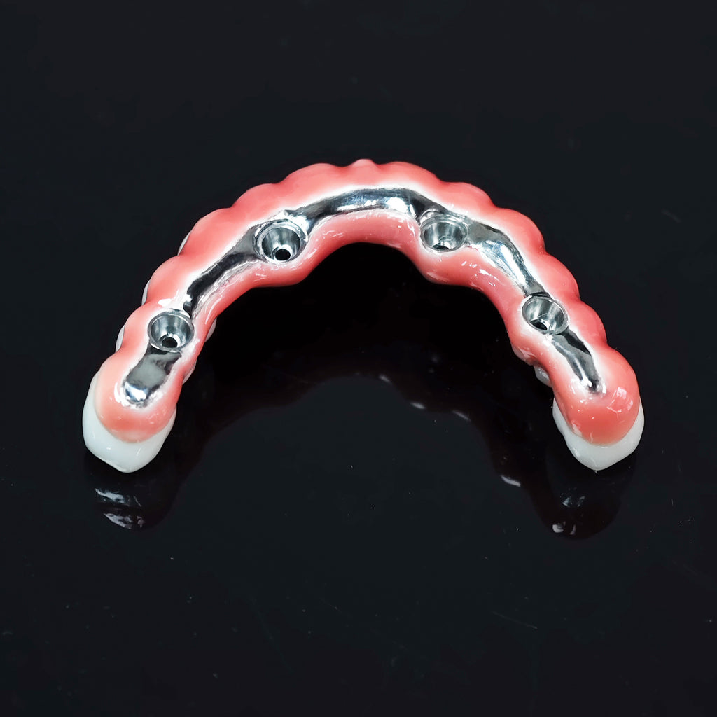 Zirconia-Enamel Hybrid Malo Bridge