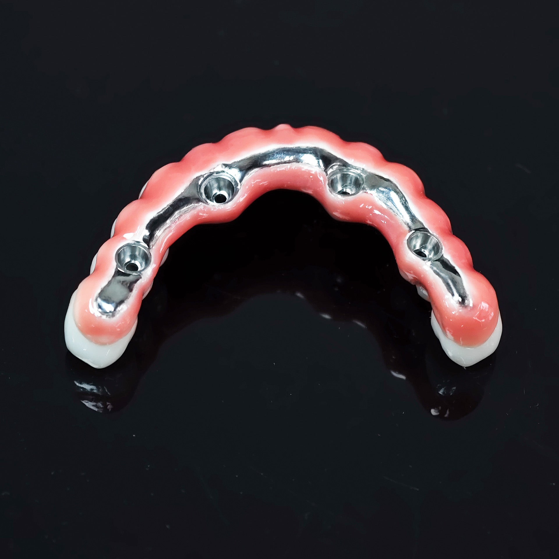 Zirconia-Enamel Hybrid Malo Bridge