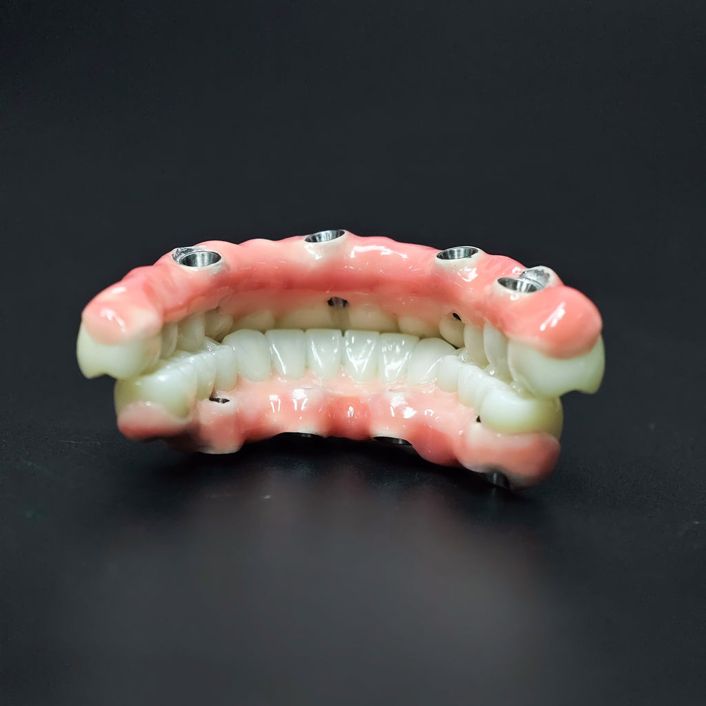 Zirconia-Enamel Hybrid Malo Bridge