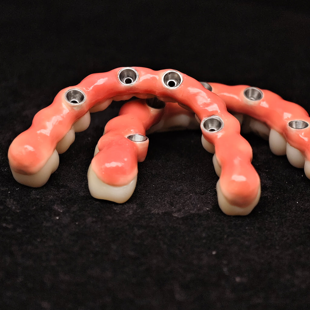 Zirconia-Enamel Hybrid Malo Bridge