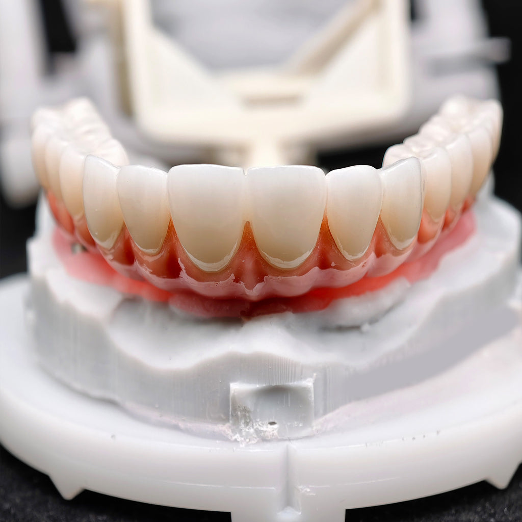 Zirconia-Enamel Hybrid Malo Bridge