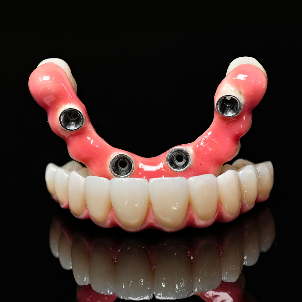 Zirconia-Enamel Hybrid Malo Bridge