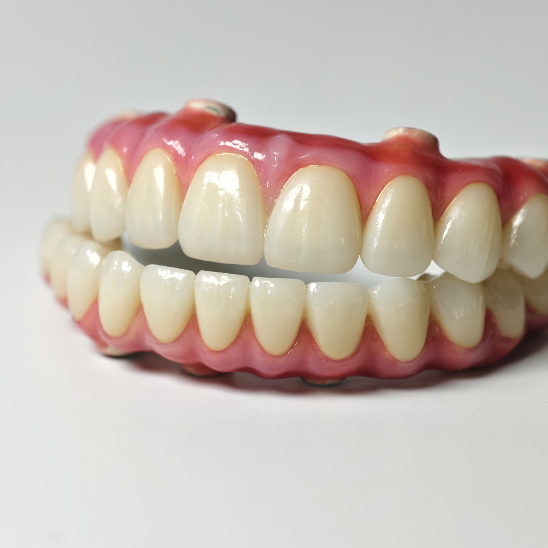 Zirconia-Enamel Hybrid Malo Bridge