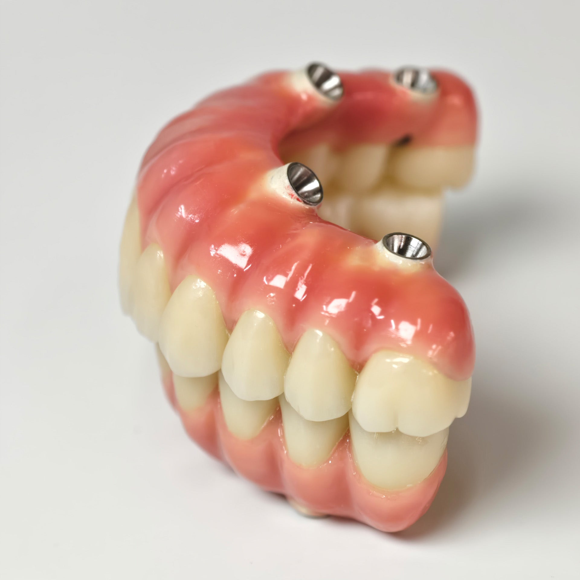 Zirconia-Enamel Hybrid Malo Bridge