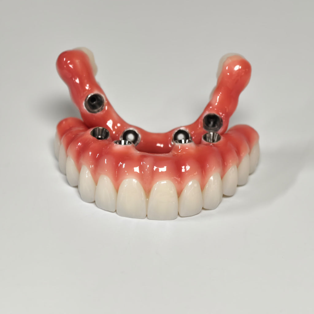 Zirconia-Enamel Hybrid Malo Bridge