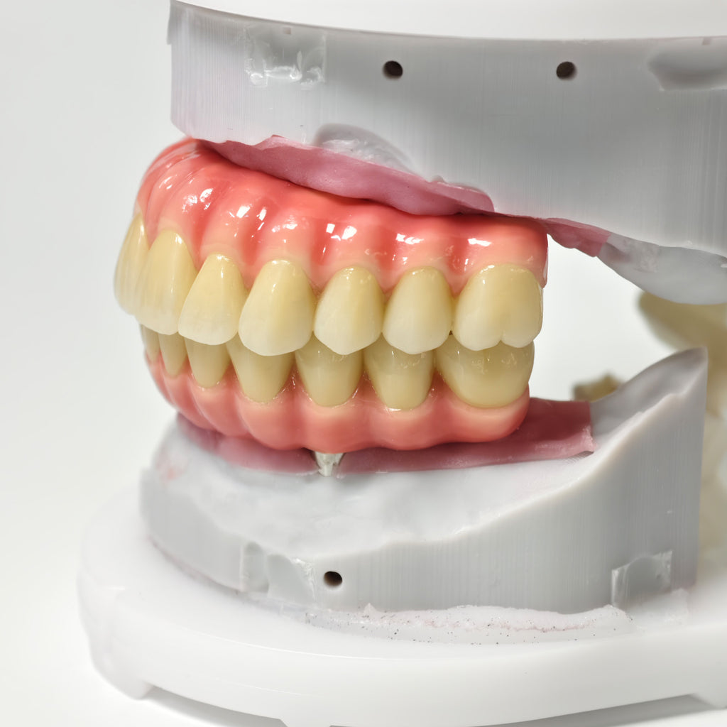 Zirconia-Enamel Hybrid Malo Bridge