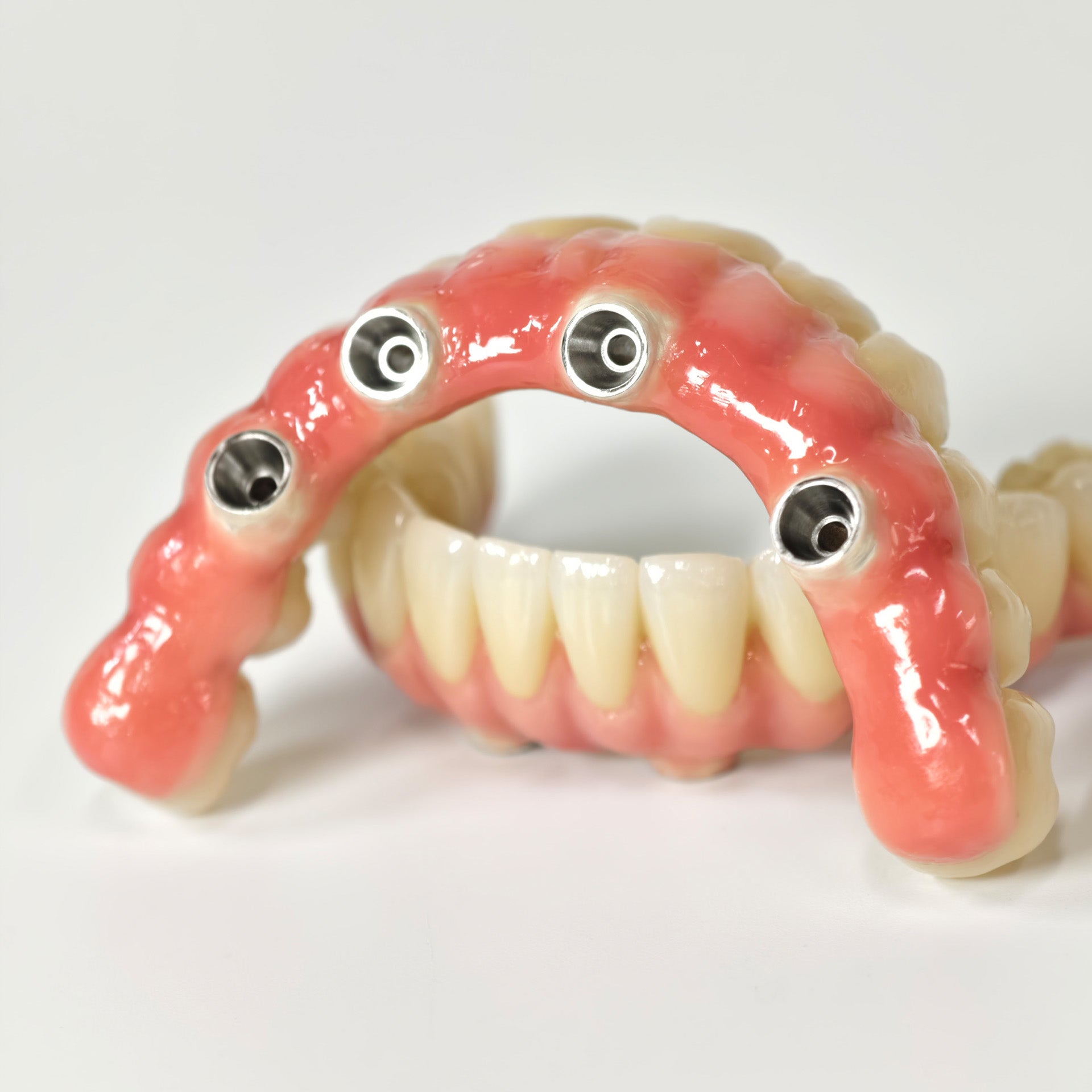 Zirconia-Enamel Hybrid Malo Bridge