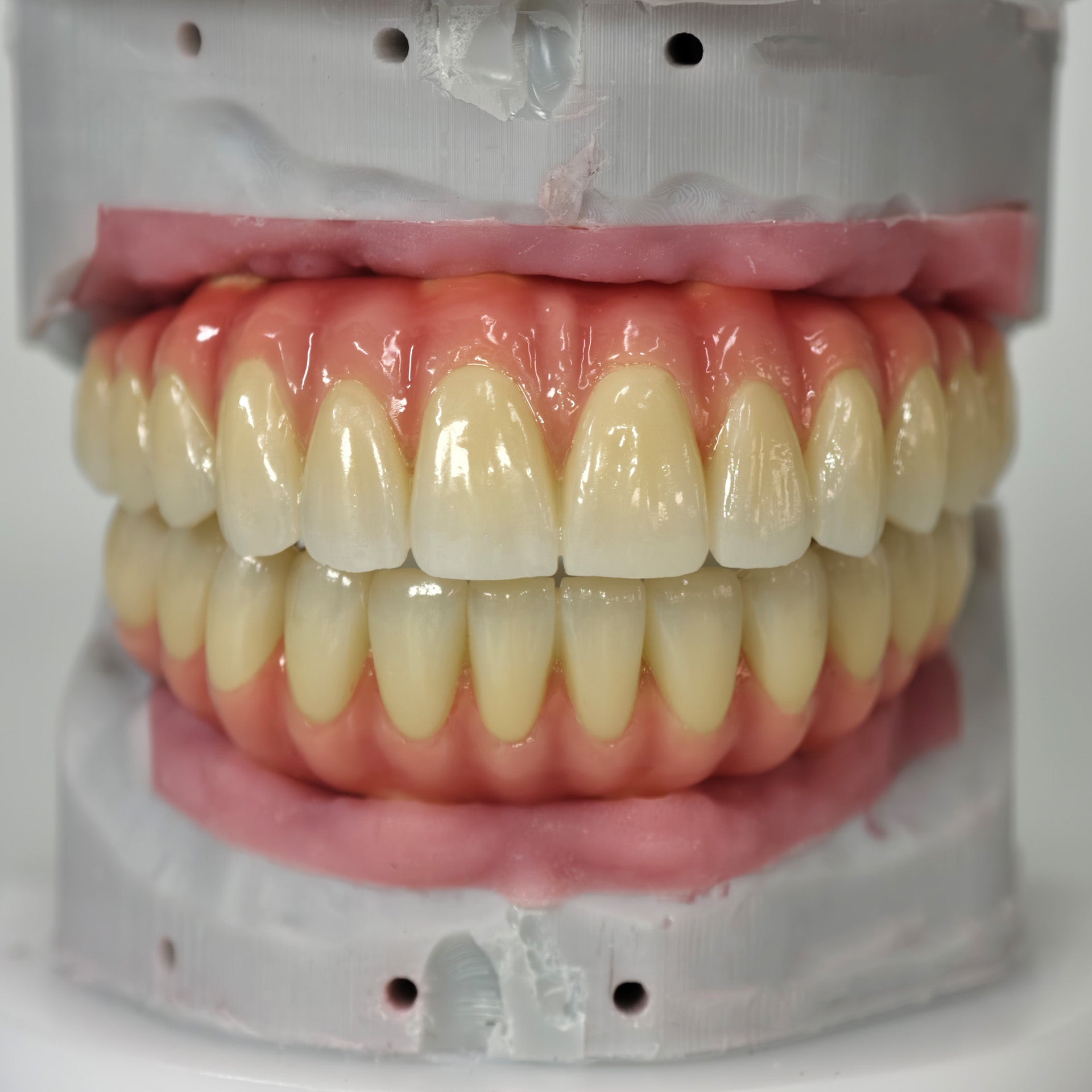 Zirconia-Enamel Hybrid Malo Bridge