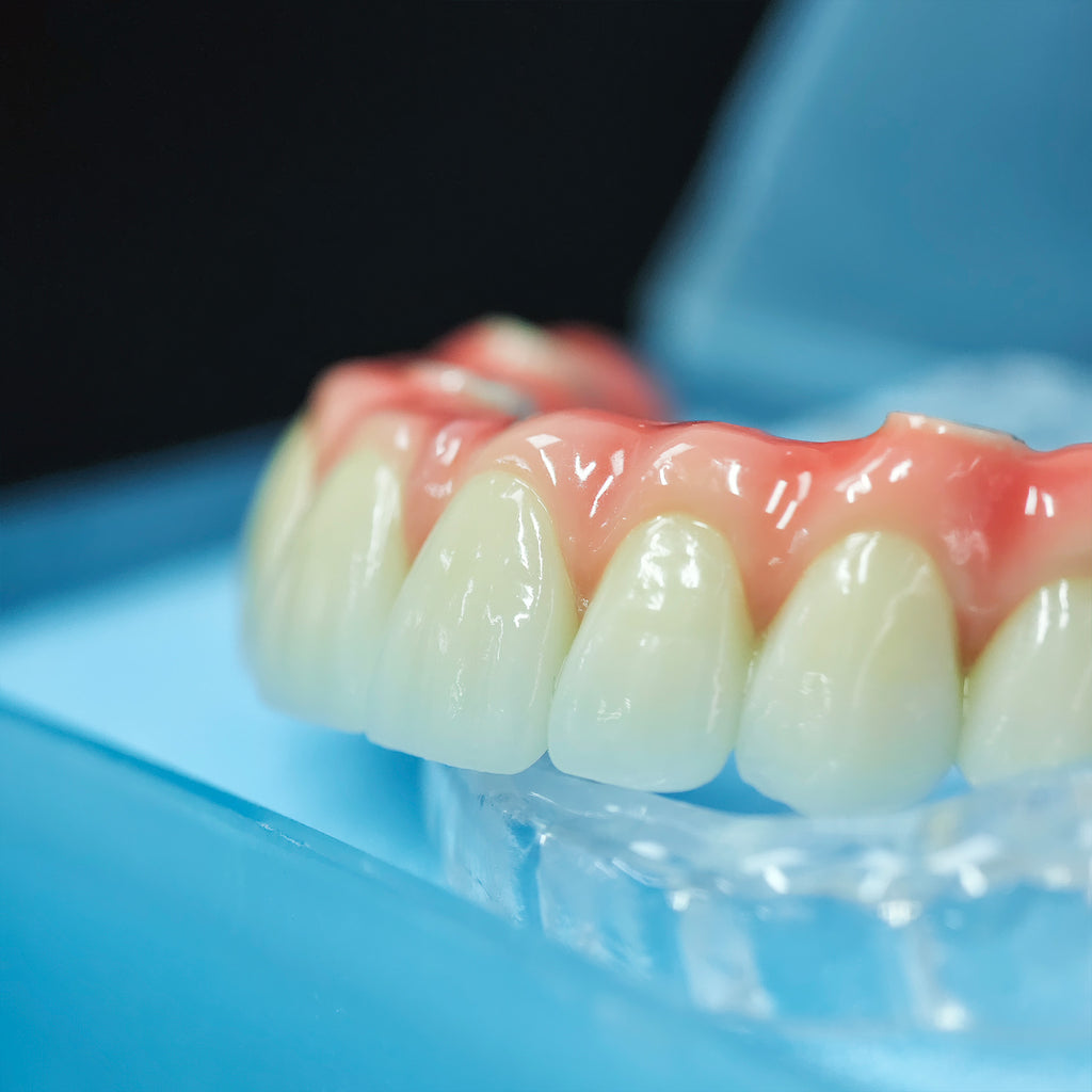 Zirconia-Enamel Hybrid Malo Bridge