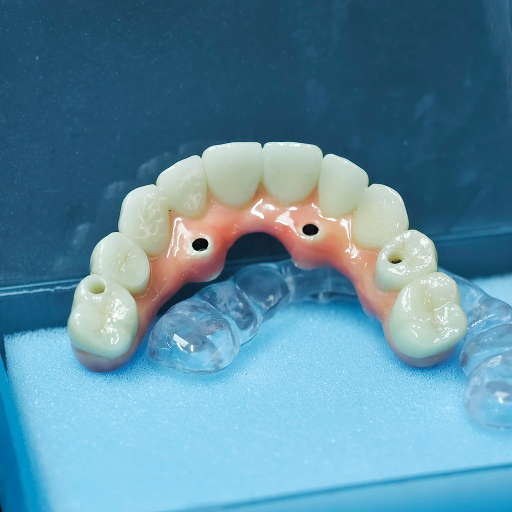 Zirconia-Enamel Hybrid Malo Bridge