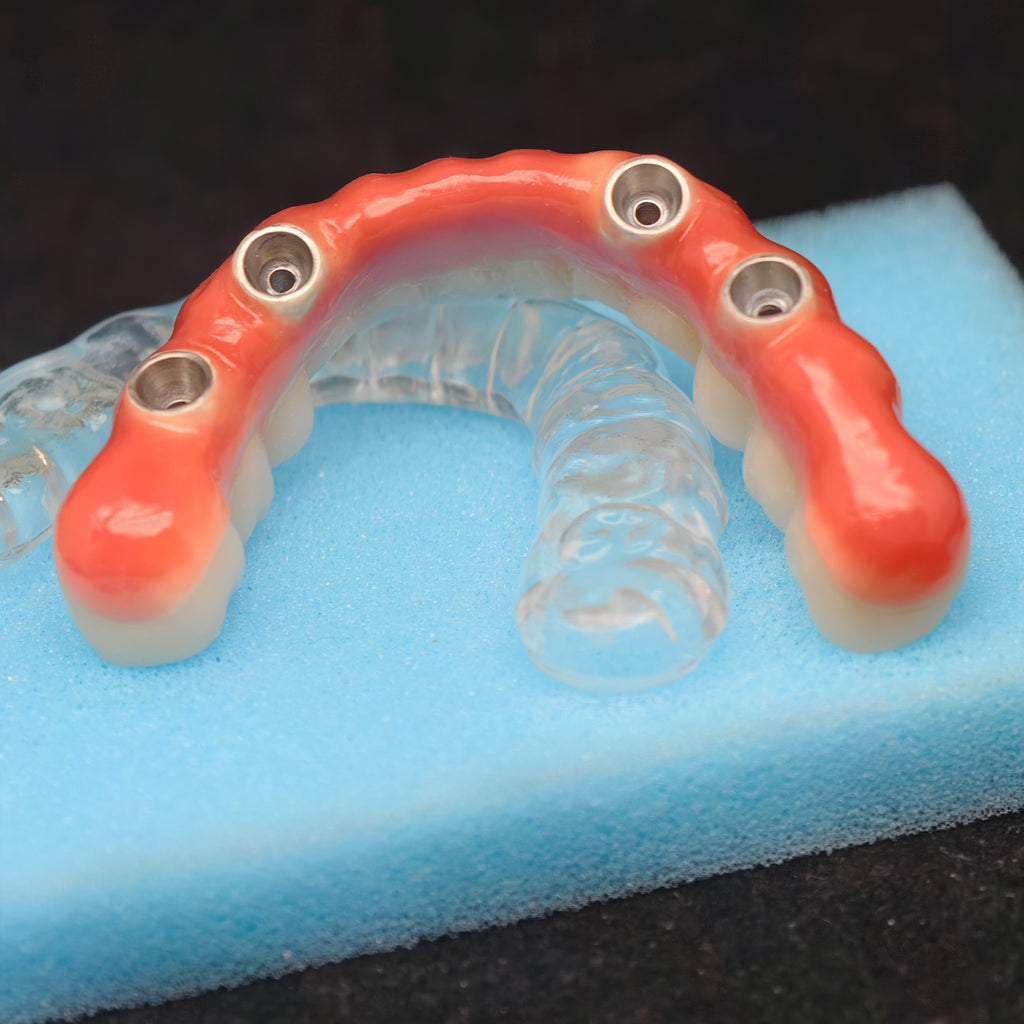 Zirconia-Enamel Hybrid Malo Bridge