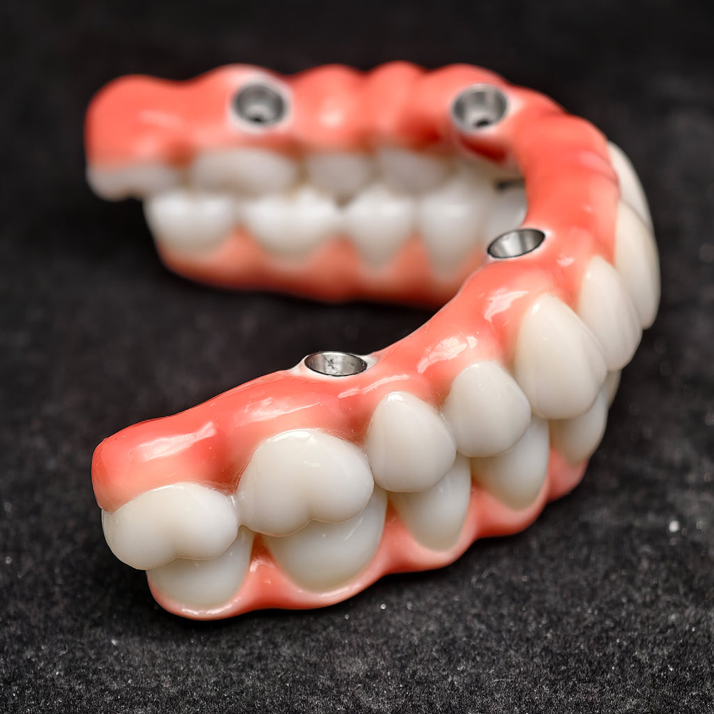 Zirconia-Enamel Hybrid Malo Bridge