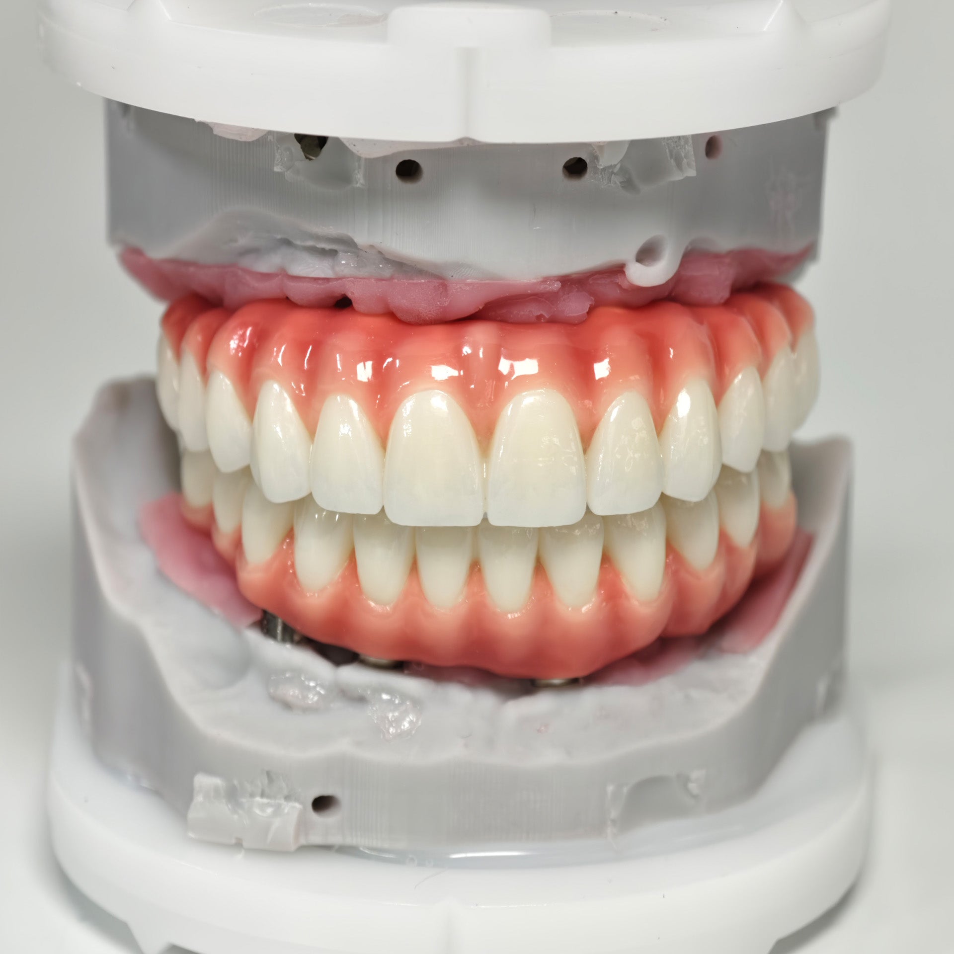 Zirconia-Enamel Hybrid Malo Bridge