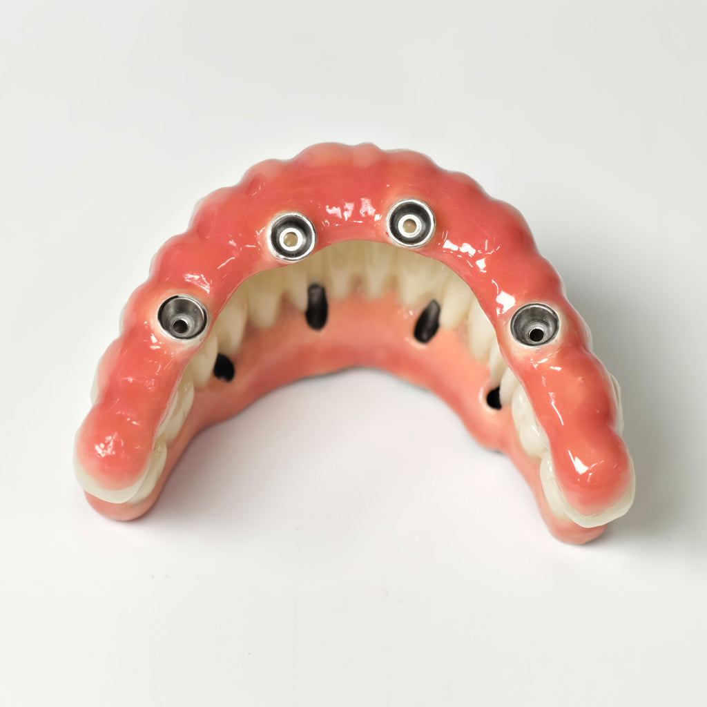 Zirconia-Enamel Hybrid Malo Bridge
