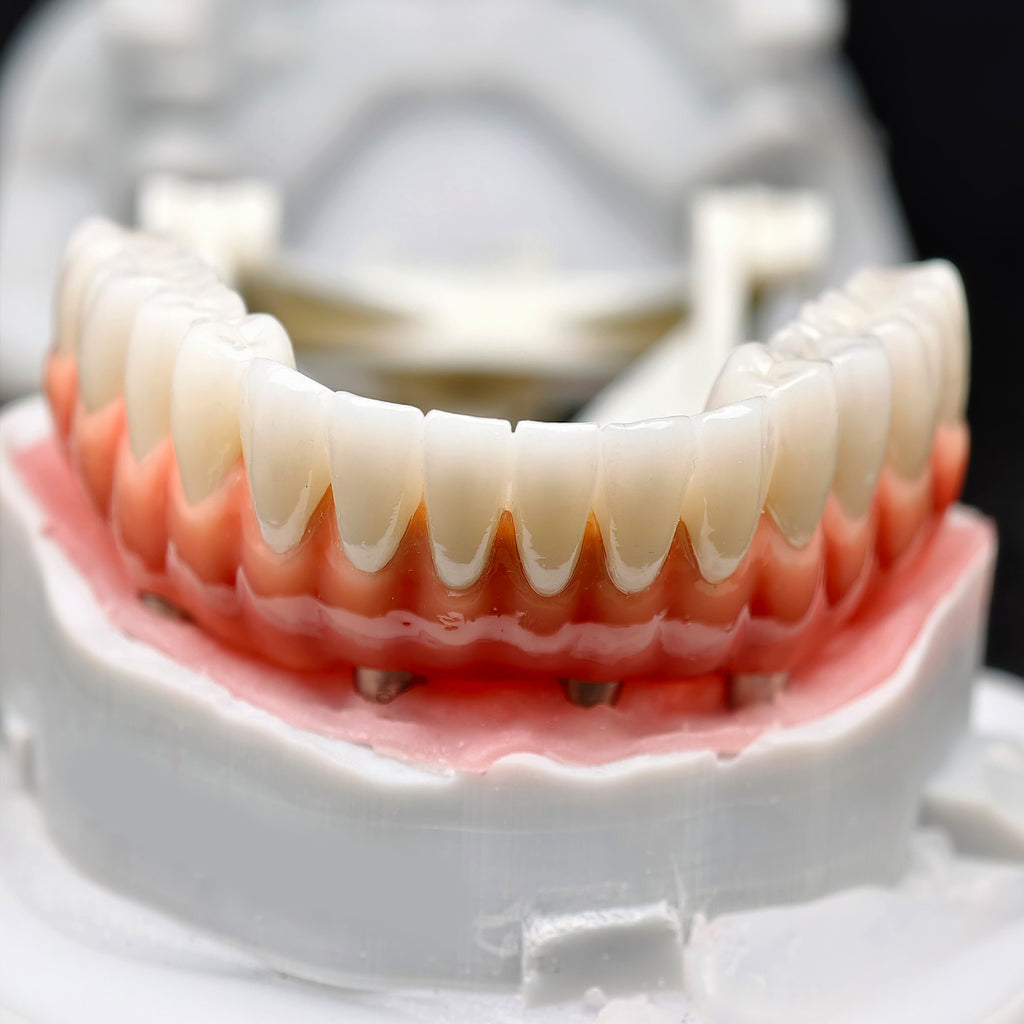 Zirconia-Enamel Hybrid Malo Bridge