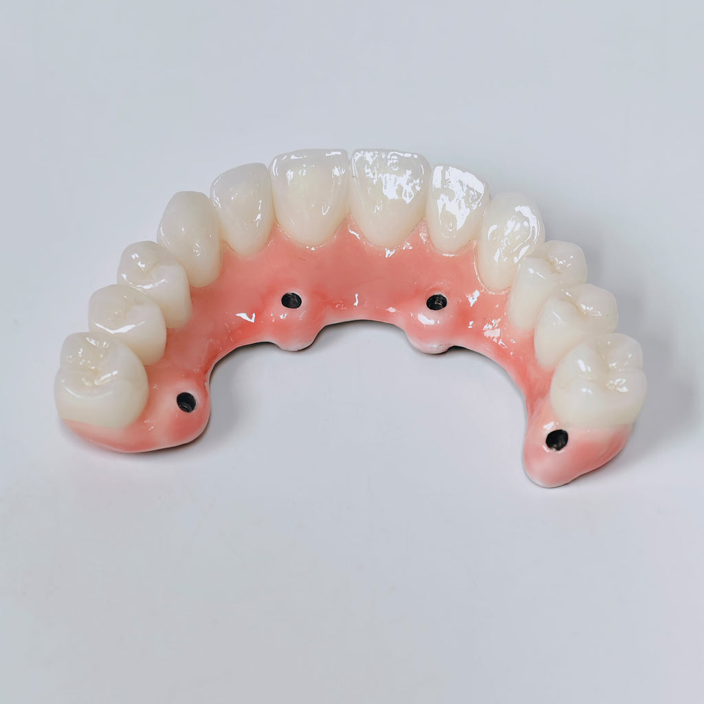 Zirconia-Enamel Hybrid Malo Bridge