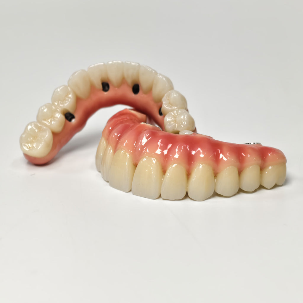 Zirconia-Enamel Hybrid Malo Bridge