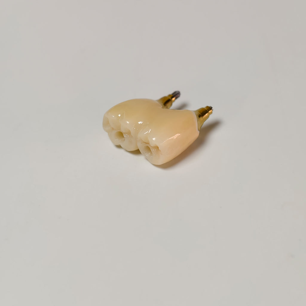 Zirconia Bridge With Screw Retained