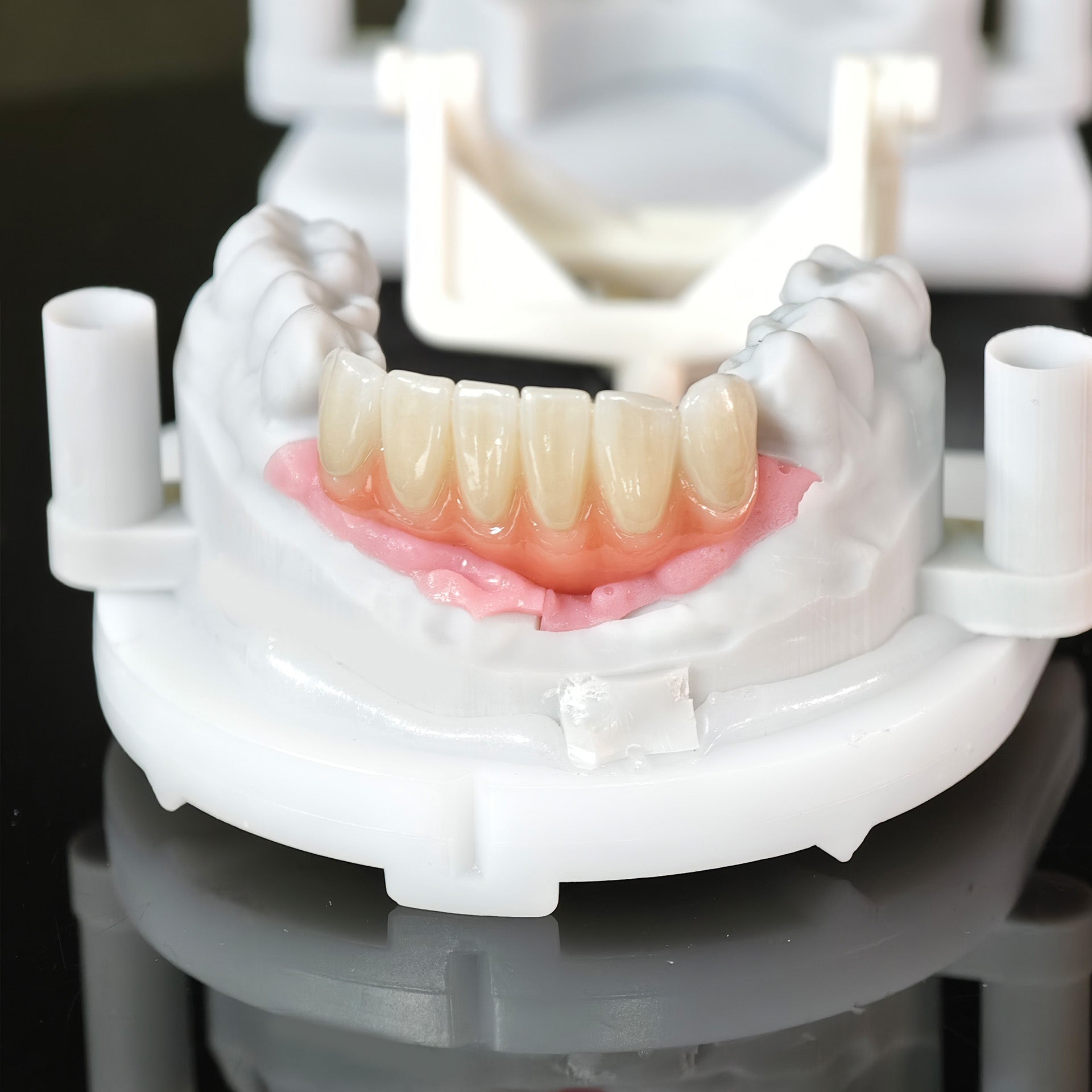 Zirconia Bridge With Ti-Base Screw Retained