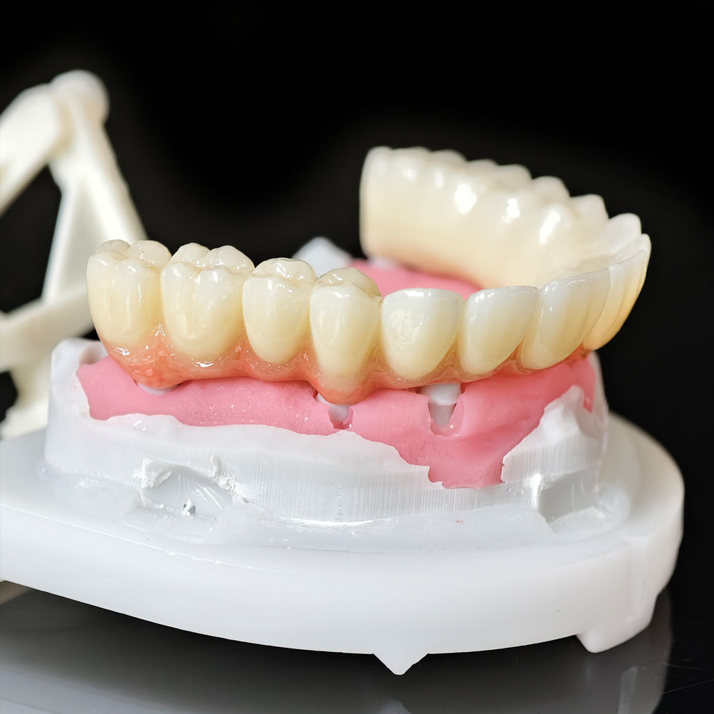 Zirconia Bridge With Cement Retained