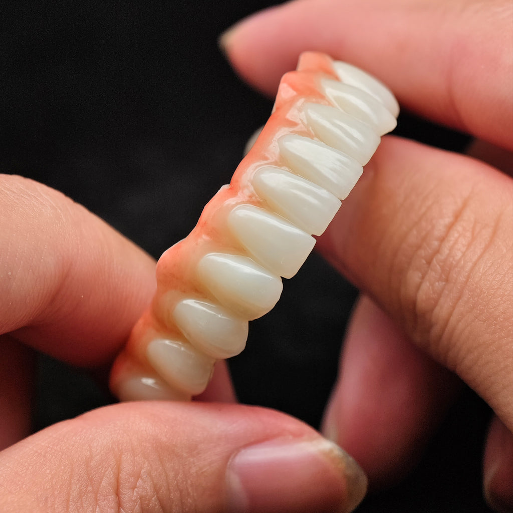 Zirconia Bridge With Cement Retained