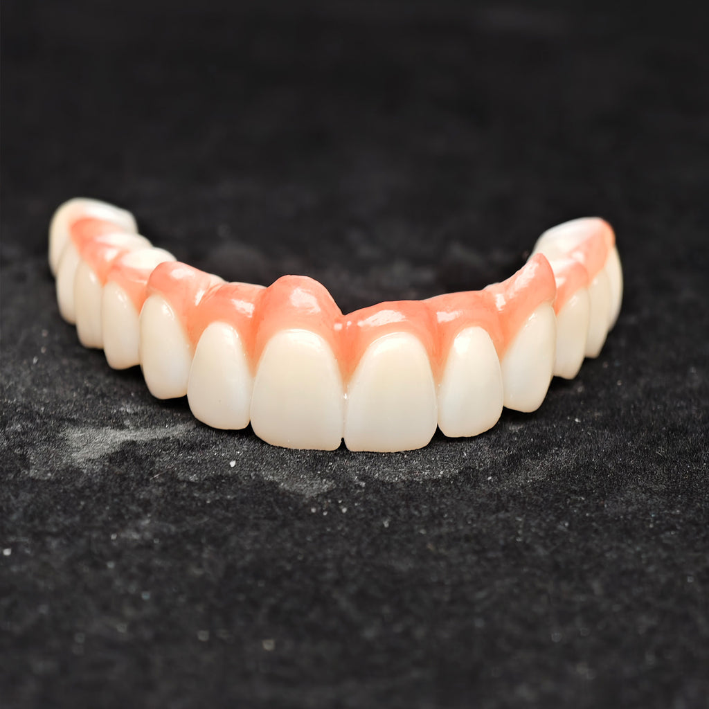 Zirconia Bridge With Cement Retained