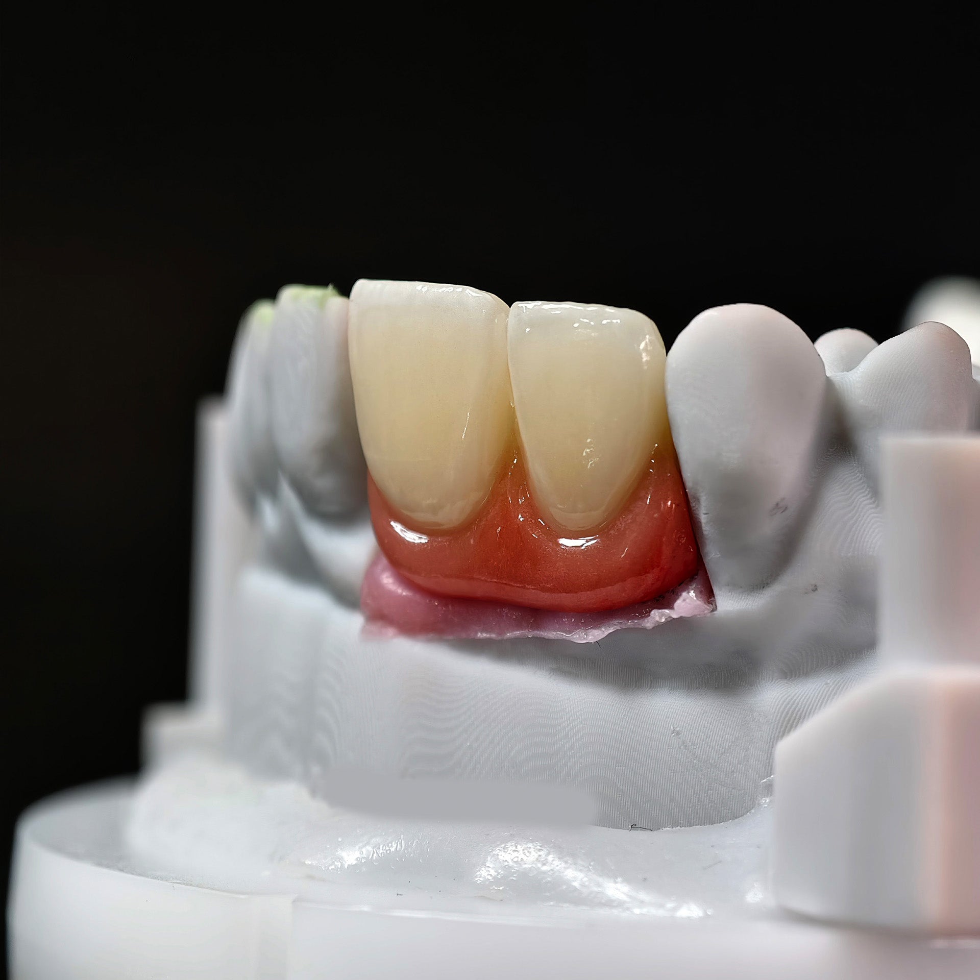 Zirconia Bridge With Ti-Base Bautment