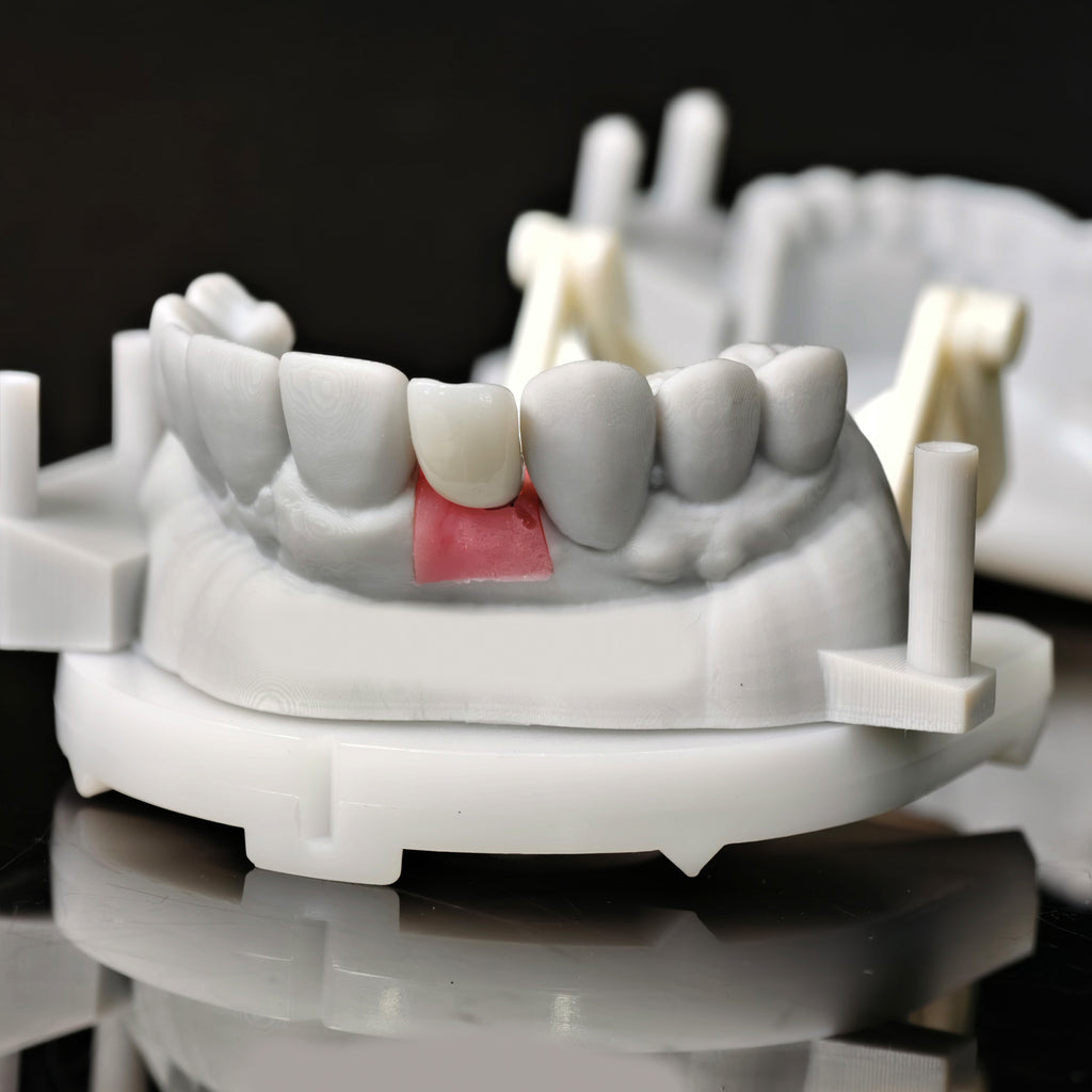 Zirconia Crown With Screw Retained