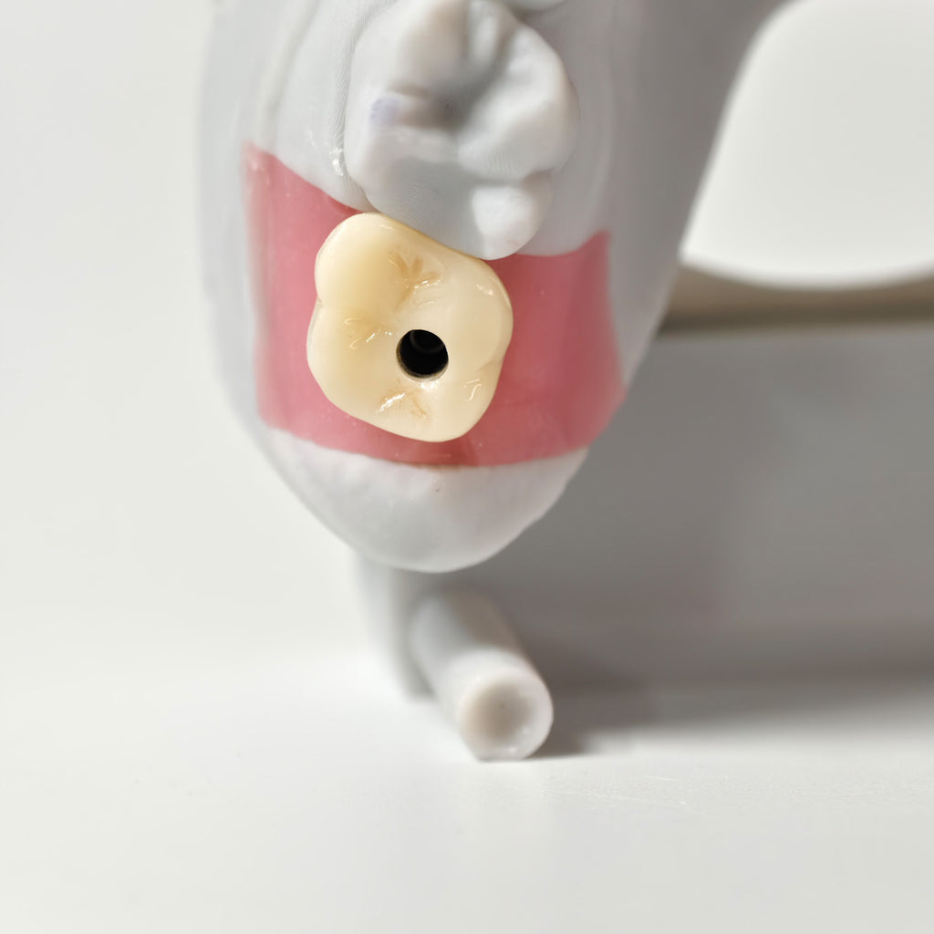 Zirconia Crown With Screw Retained