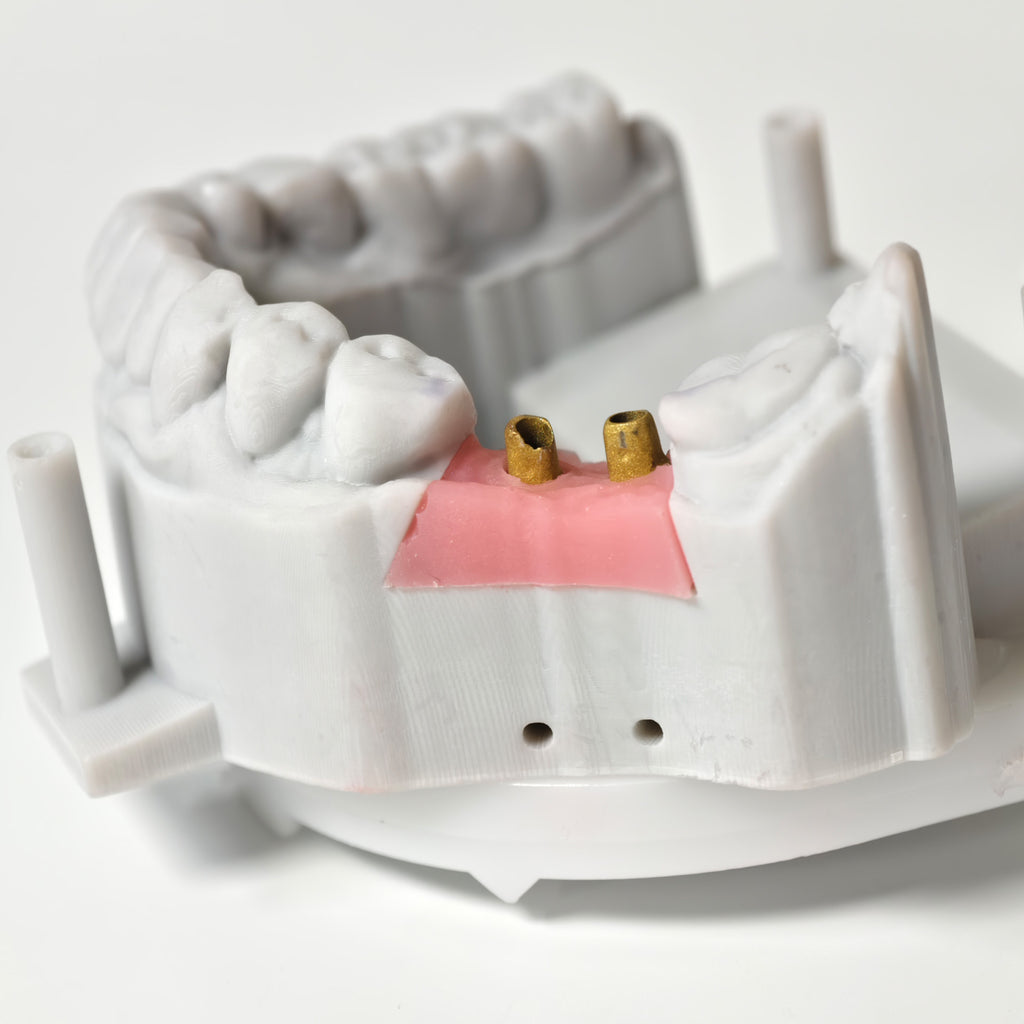 Zirconia Implant Bridge Screwmentable Dental Crown