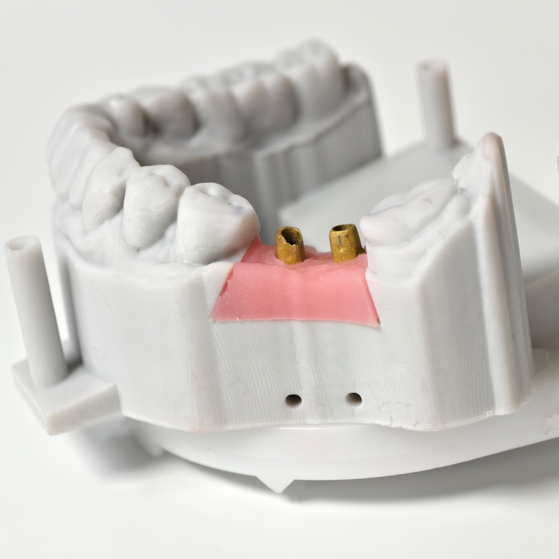 Zirconia Implant Bridge Screwmentable Dental Crown