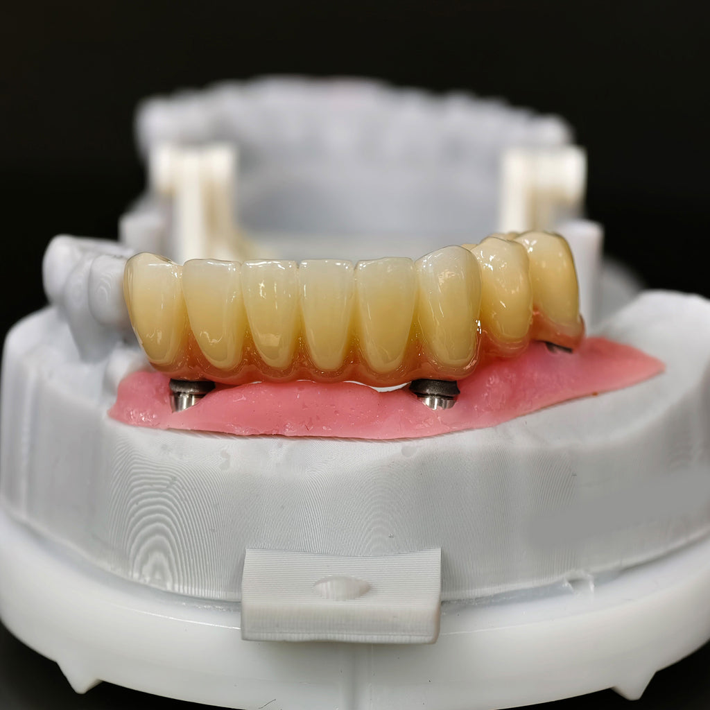 Zirconia Implant Bridge Screwmentable Dental Crown