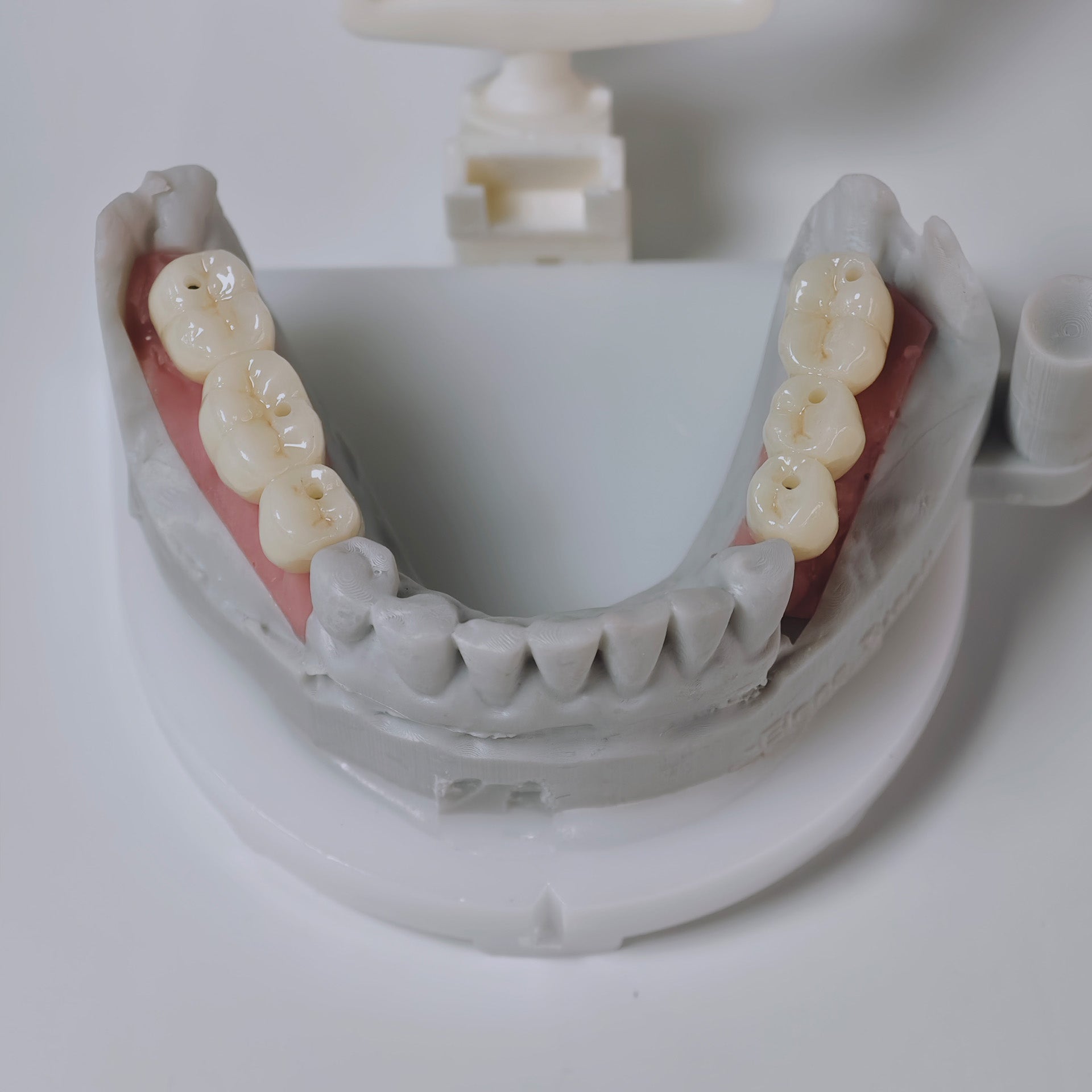 Zirconia Implant Bridges Screwmentable Dental Crown