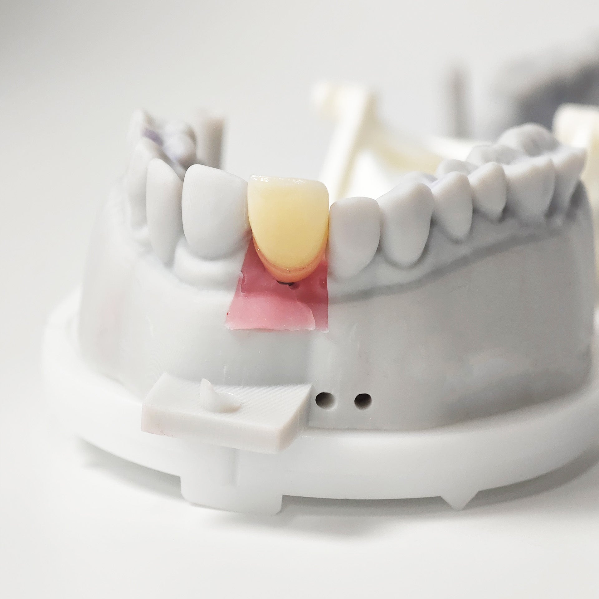 Zirconia Implant Crown Screwmentable Dental Crown