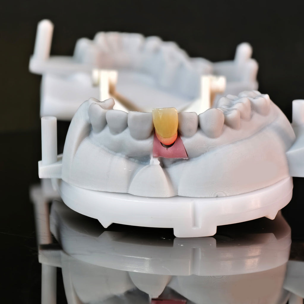 Zirconia Implant Crown Screwmentable Dental Crown