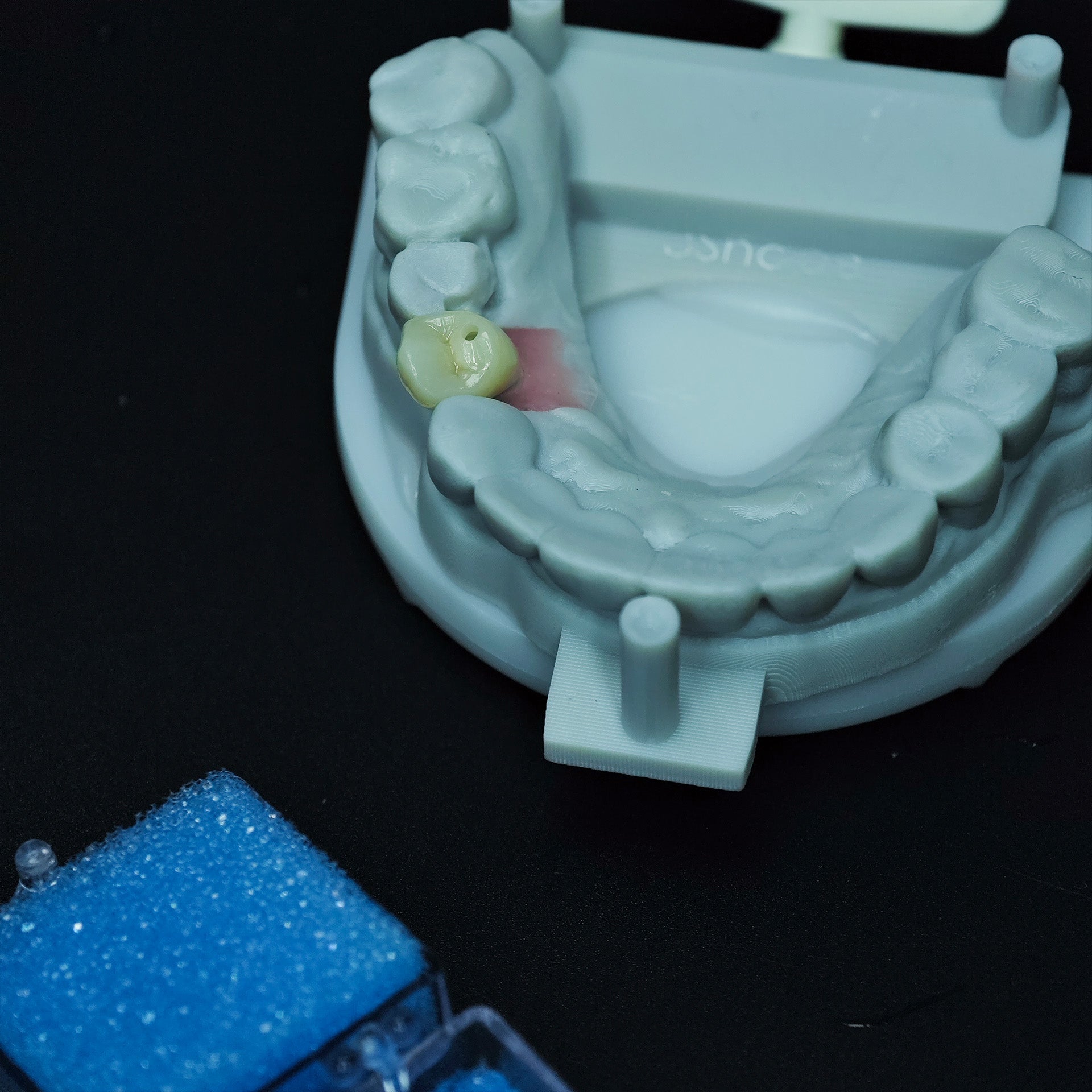 Zirconia Implant Crown Screwmentable Dental Crown