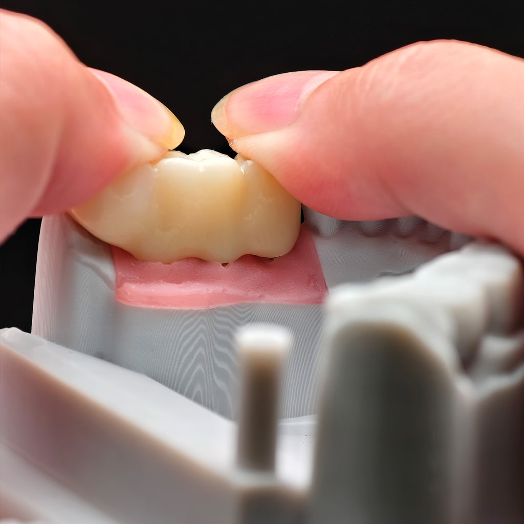 Zirconia Implant Crown Screwmentable Dental Crown