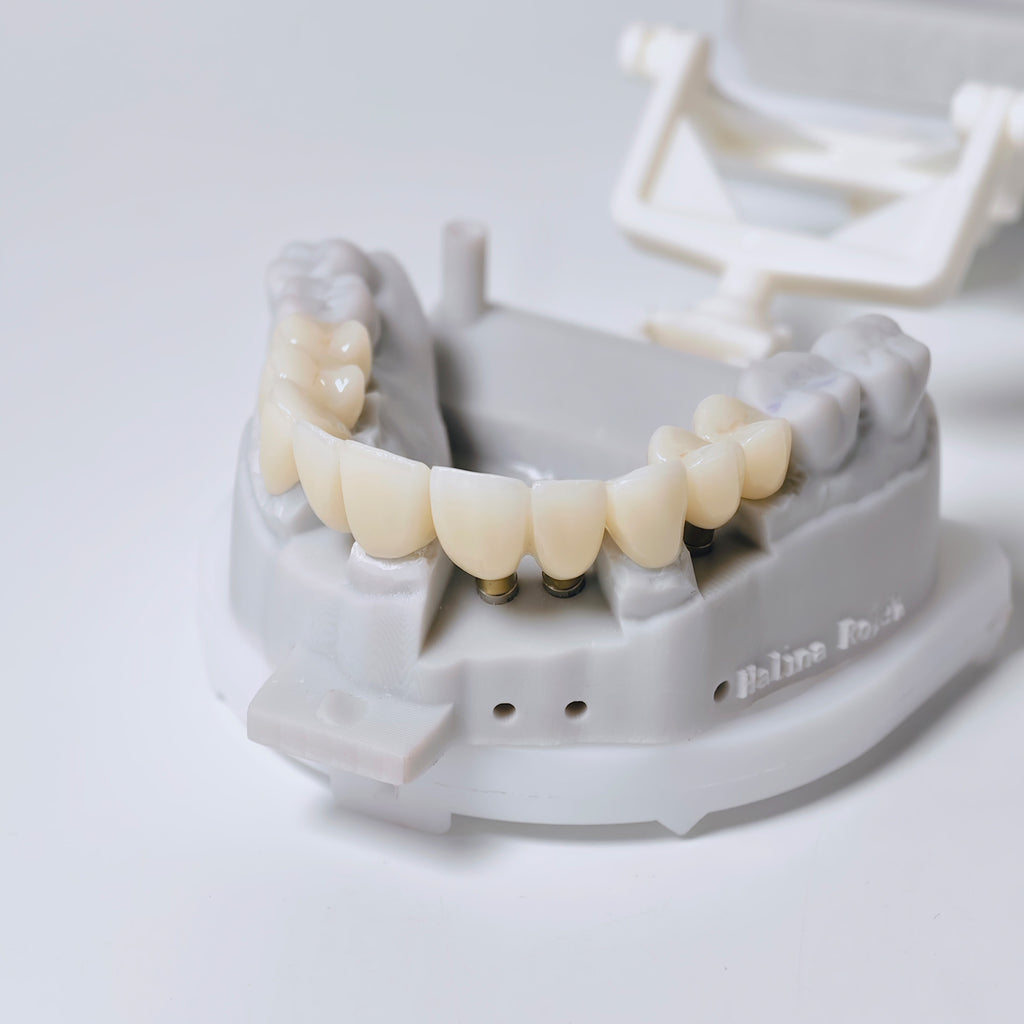 Zirconia Implant Crown And Bridge Screwmentable Dental Crown