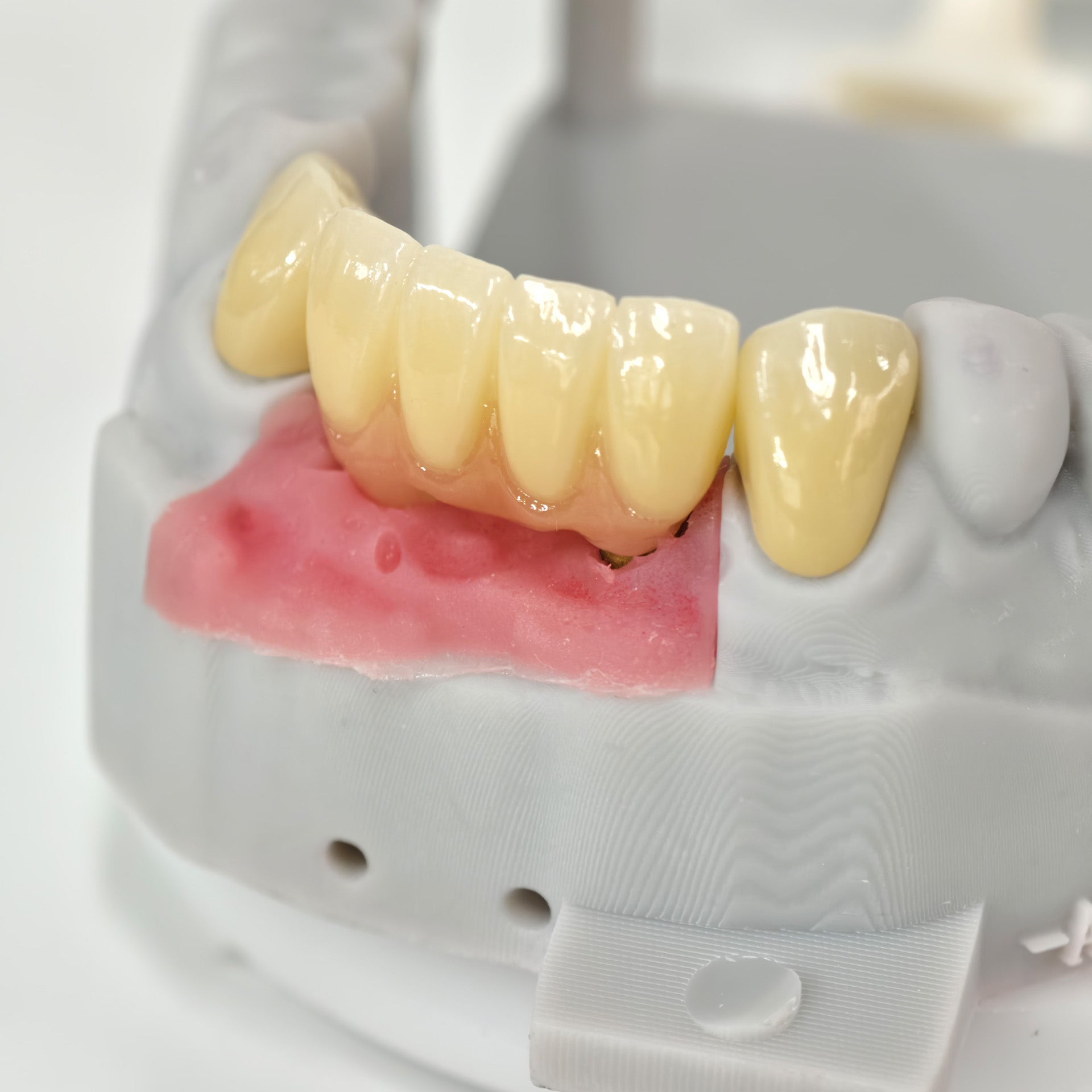 Zirconia Implant Crown And Bridge Screwmentable Dental Crown