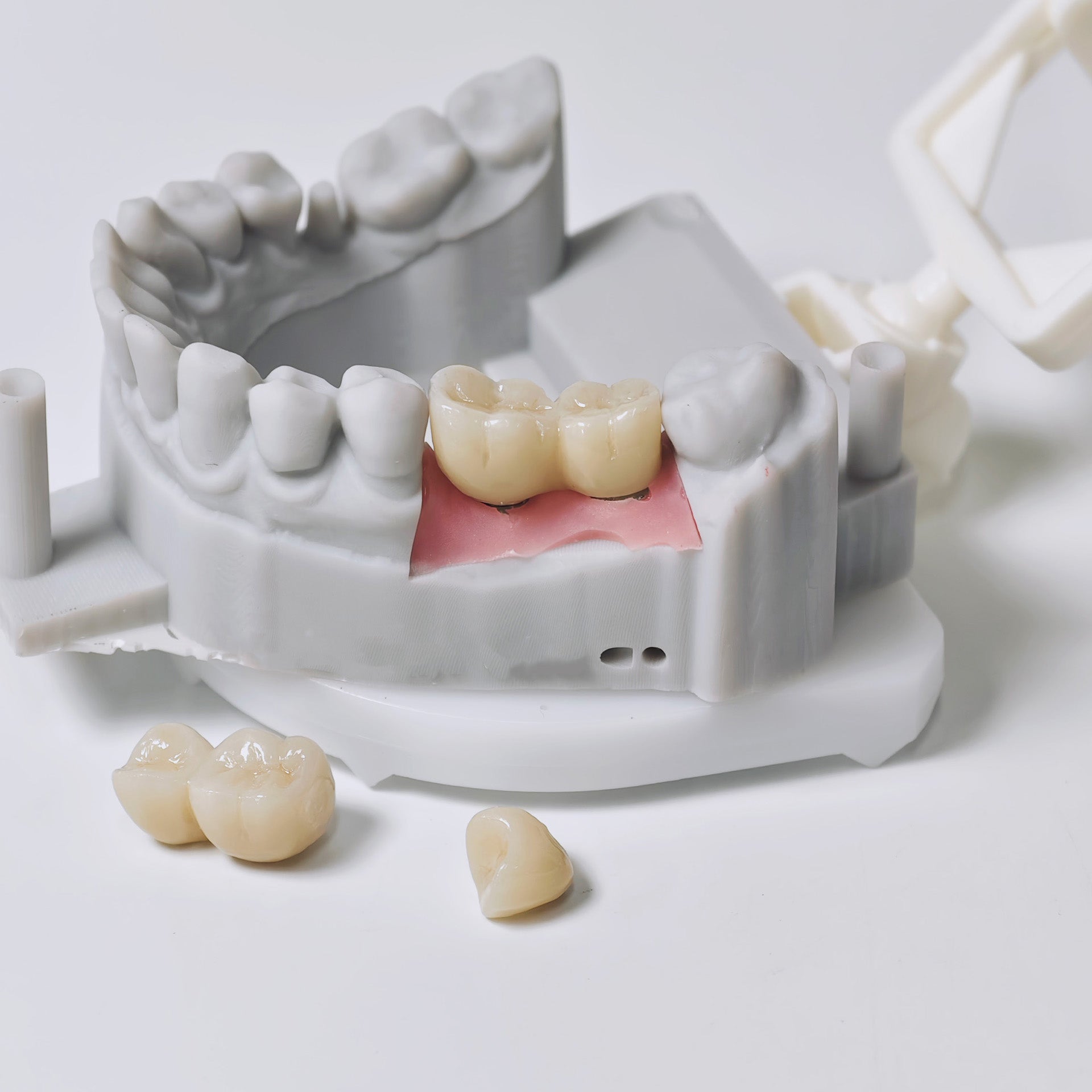 Zirconia Implant Crowns And Bridges Screwmentable Dental Crown