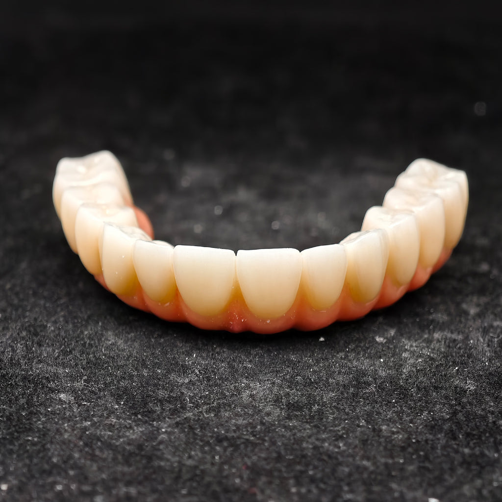 All On 4 Zirconia Bridge With Ti-Base Screw Retained Trying For Full Arch Restoration