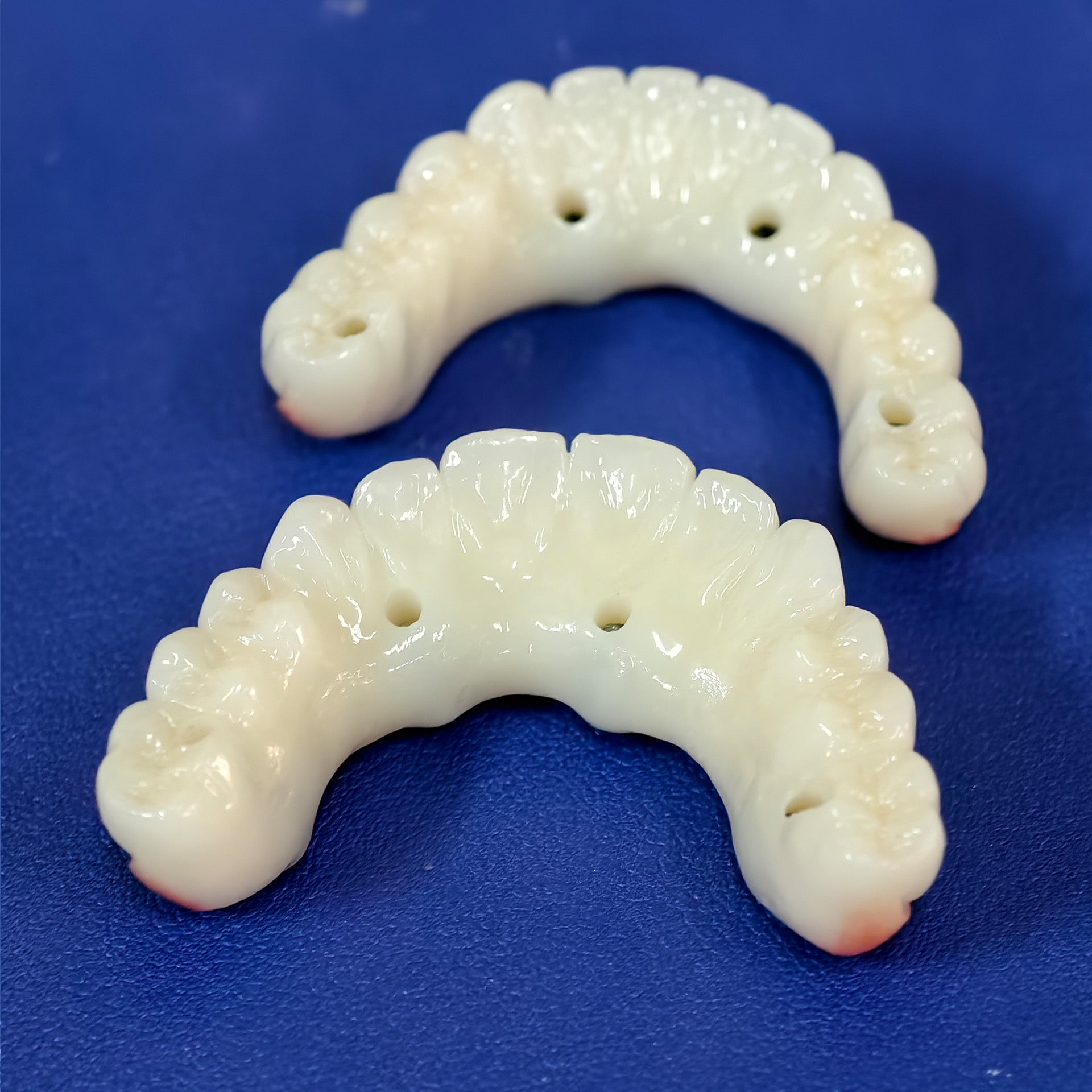 All On 4 Zirconia Bridge With Ti-Base Screw Retained Trying For Full Arch Restoration
