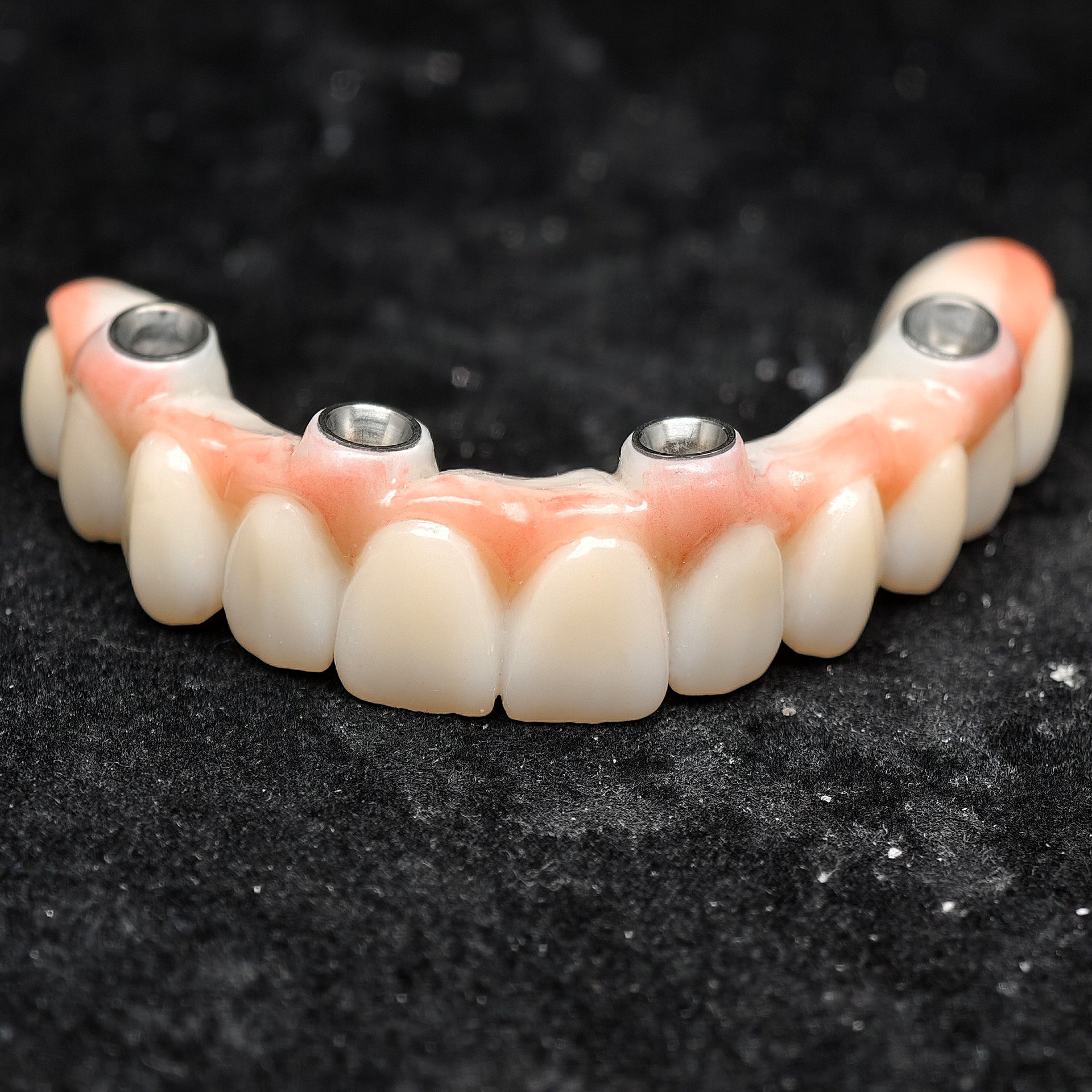 All On 4 Zirconia Bridge With Ti-Base Screw Retained Trying For Full Arch Restoration