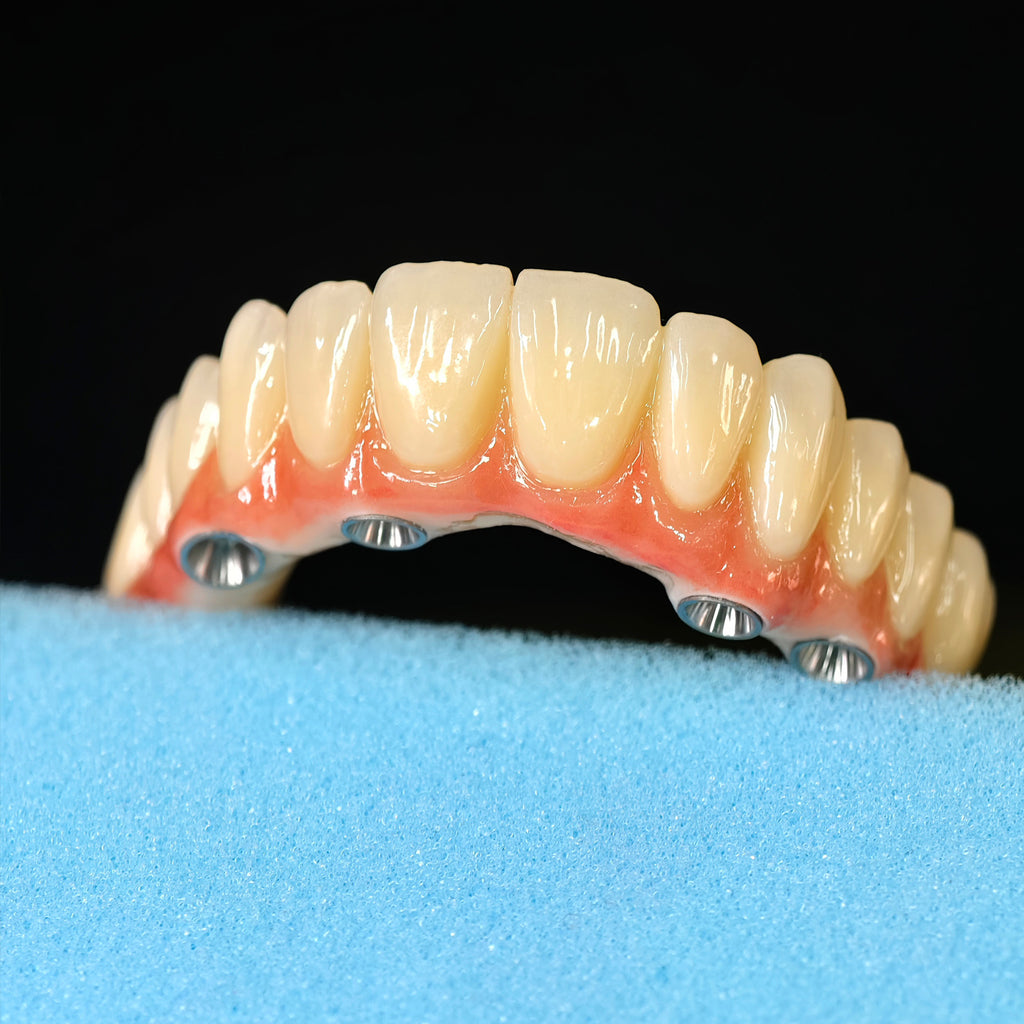 All On 5 Zirconia Bridge With Ti-Base Screw Retained Trying For Full Arch Restoration