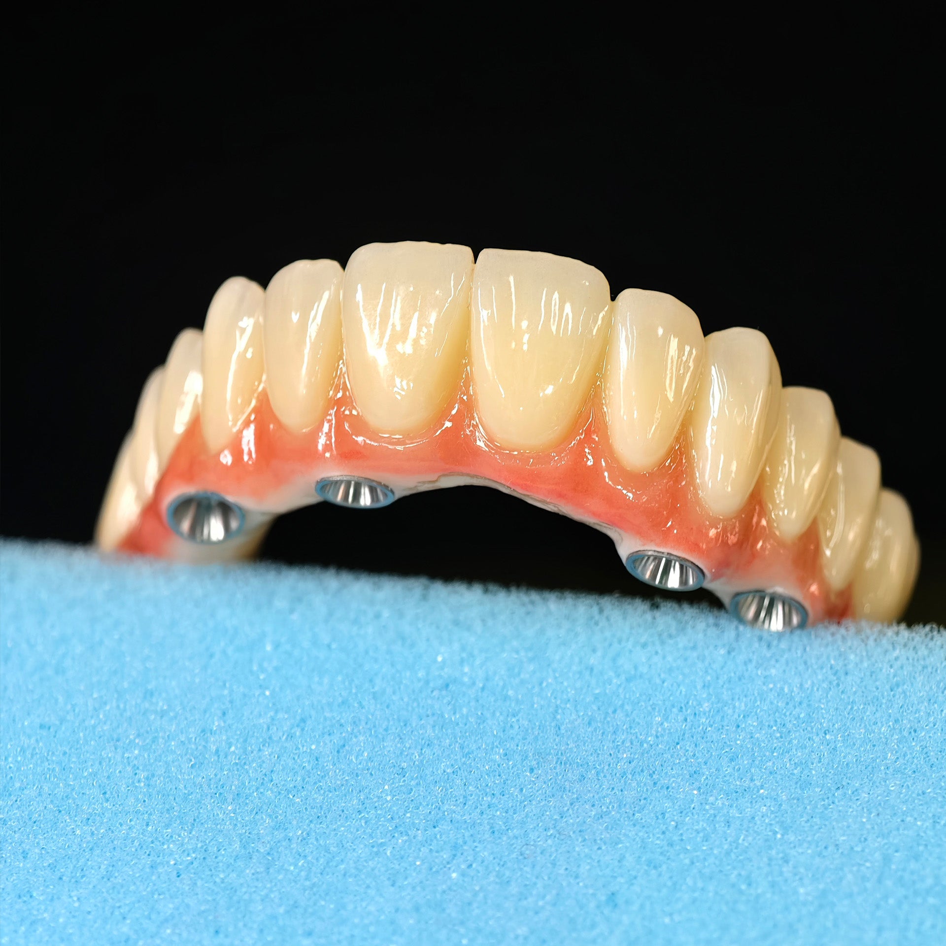 All On 5 Zirconia Bridge With Ti-Base Screw Retained Trying For Full Arch Restoration