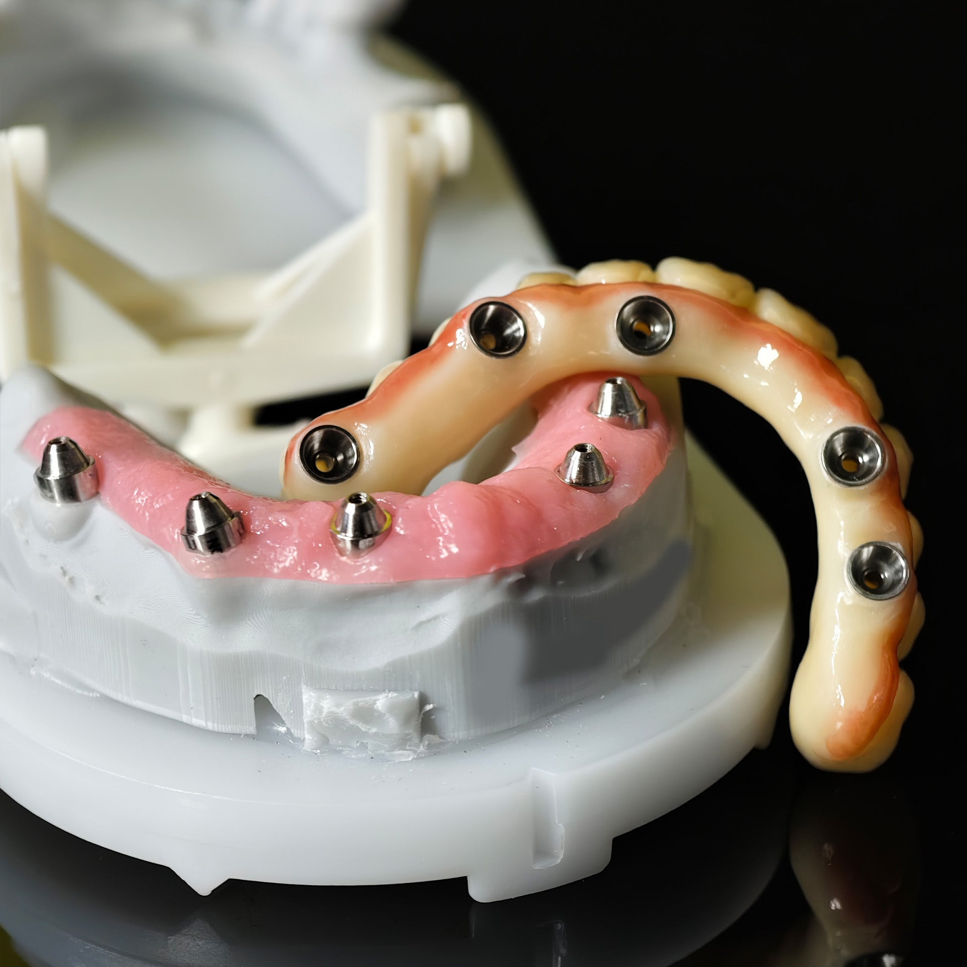 All On 5 Zirconia Bridge With Ti-Base Screw Retained Trying For Full Arch Restoration