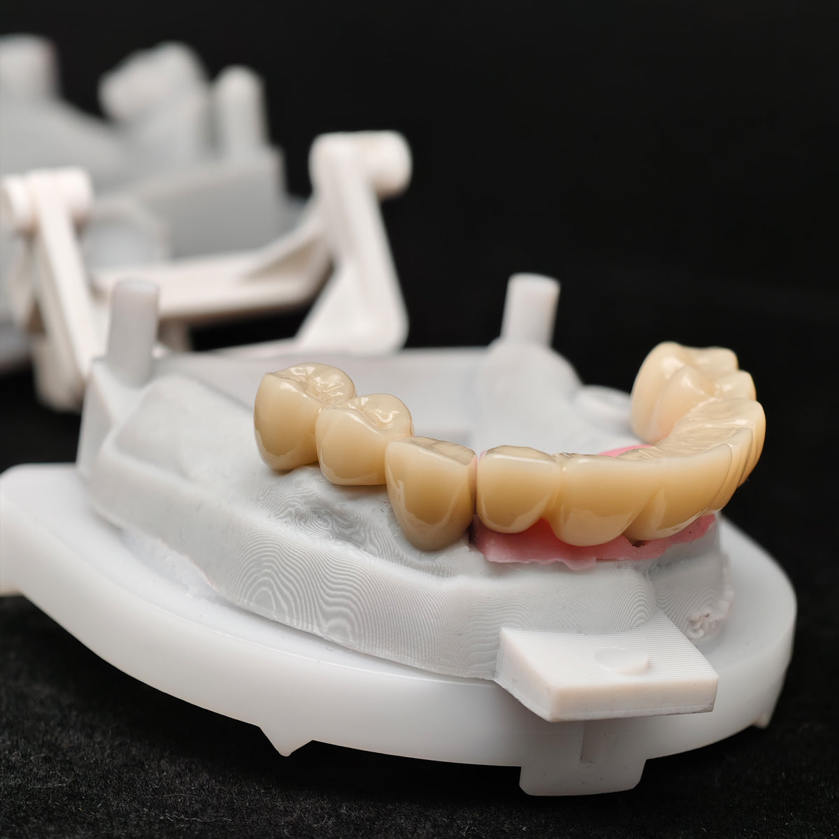 Custom Abutment With Zirconia Crown And Bridge