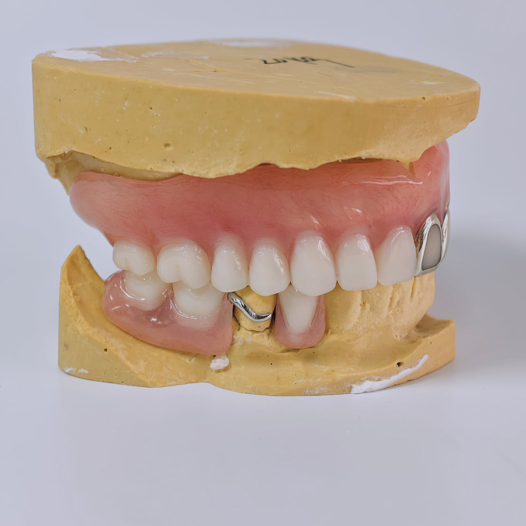 Full-Mouth Acrylic Denture