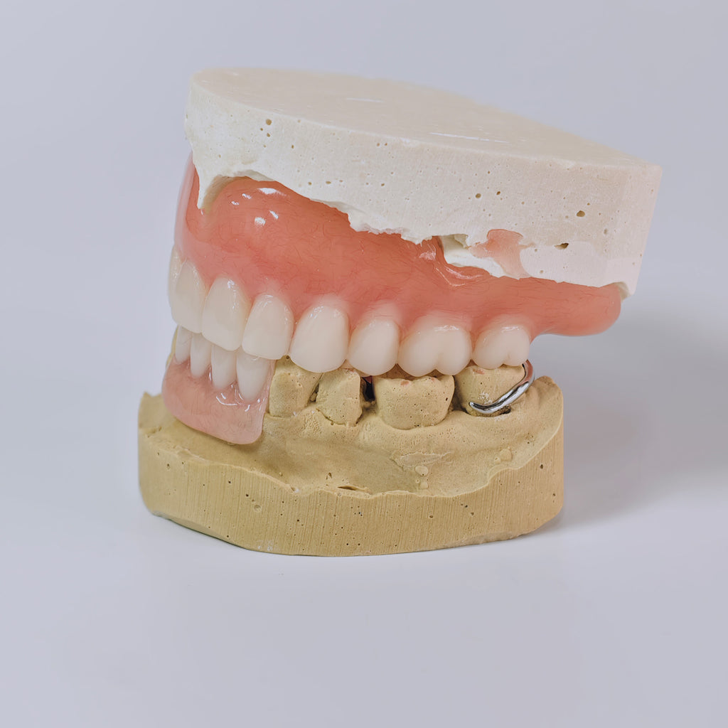 Full-Mouth Acrylic Denture